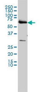 CCT6B Monoclonal Antibody (1A4)