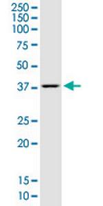 LASS1 Monoclonal Antibody (3F9)