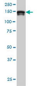 STAG2 Antibody in Western Blot (WB)
