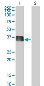 SIX2 Monoclonal Antibody (3D7)