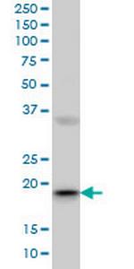 RBBP9 Monoclonal Antibody (2A11)