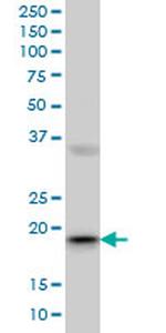 RBBP9 Antibody in Western Blot (WB)