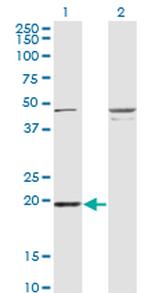 RBBP9 Antibody in Western Blot (WB)