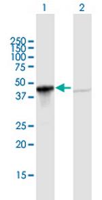 GIPC1 Polyclonal Antibody, MaxPab™