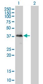 TOB2 Antibody in Western Blot (WB)