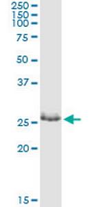 ZNF266 Monoclonal Antibody (1B9)