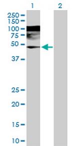 WDR4 Polyclonal Antibody, MaxPab™
