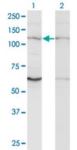 ZNF268 Monoclonal Antibody (3B4)