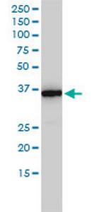 MTHFD2 Monoclonal Antibody (4G7-2G3)