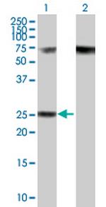 RPP40 Polyclonal Antibody, MaxPab™
