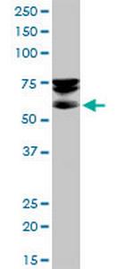 SEPT9 Polyclonal Antibody, MaxPab™