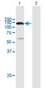 UTP14A Polyclonal Antibody, MaxPab™