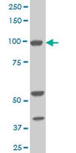 ALDH1L1 Antibody in Western Blot (WB)
