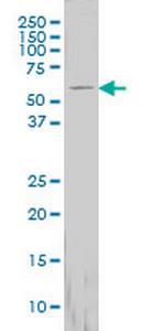 FTCD Monoclonal Antibody (3A4)