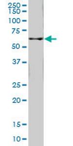 FTCD Monoclonal Antibody (5F6)