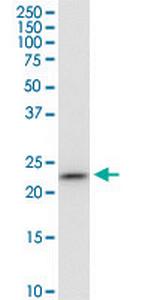 PGRMC1 Monoclonal Antibody (3F7)