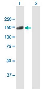 USP20 Antibody in Western Blot (WB)