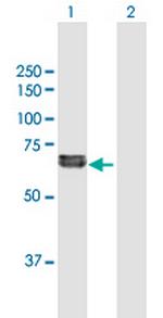 FGL2 Polyclonal Antibody, MaxPab™