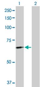 FGL2 Polyclonal Antibody, MaxPab™
