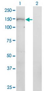 NTE Antibody in Western Blot (WB)