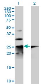 COPS8 Polyclonal Antibody, MaxPab™