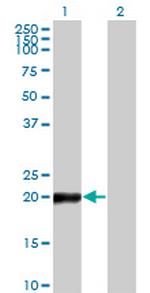 COPS8 Monoclonal Antibody (2G8)
