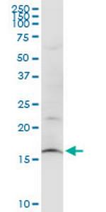 SUB1 Monoclonal Antibody (3A1)