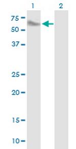 SMPDL3A Antibody in Western Blot (WB)