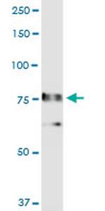 RALBP1 Antibody in Western Blot (WB)