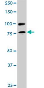 RALBP1 Antibody in Western Blot (WB)