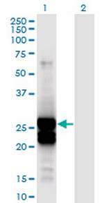APOBEC2 Monoclonal Antibody (4D7)