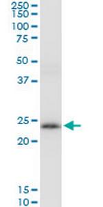 PRDX3 Polyclonal Antibody, MaxPab™