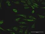 PRDX3 Polyclonal Antibody, MaxPab™