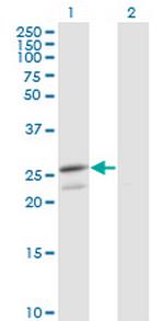 PRDX3 Monoclonal Antibody (1E3-B2)