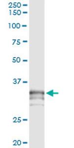 PRSS21 Monoclonal Antibody (2E10)