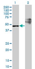 STARD3 Monoclonal Antibody (1D1)