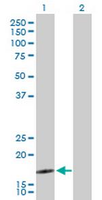SEC61B Antibody in Western Blot (WB)