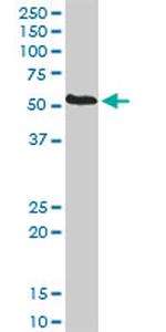 PDIA5 Antibody in Western Blot (WB)