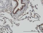 STIP1 Antibody in Immunohistochemistry (Paraffin) (IHC (P))