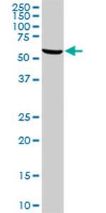 STIP1 Antibody in Western Blot (WB)