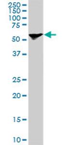 STIP1 Antibody in Western Blot (WB)