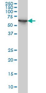 STIP1 Antibody in Western Blot (WB)
