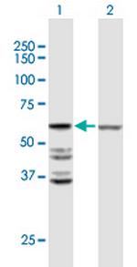 ACOT2 Polyclonal Antibody, MaxPab™