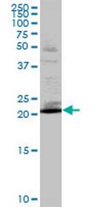 RAB32 Polyclonal Antibody, MaxPab™