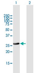 RAB32 Polyclonal Antibody, MaxPab™