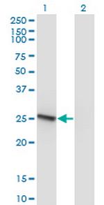 RAB32 Monoclonal Antibody (1C7)
