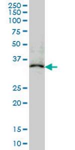 MAPRE2 Monoclonal Antibody (4D7)