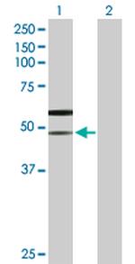 SLC38A3 Polyclonal Antibody, MaxPab™