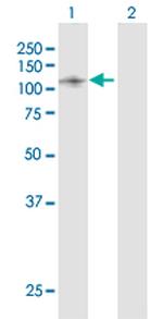 SF3B2 Antibody in Western Blot (WB)