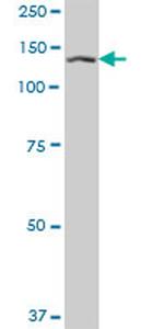 SF3B2 Antibody in Western Blot (WB)